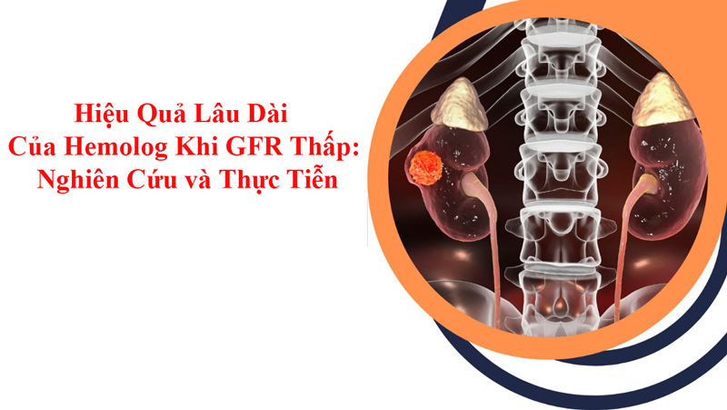 Hiệu Quả Lâu Dài Của Hemolog Khi GFR Thấp: Nghiên Cứu và Thực Tiễn